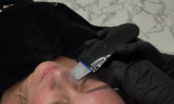 Чистка лица Косметолог-эстетист Светлана Днепр