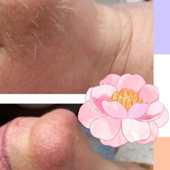 Літня пані тепер не має проблеми.