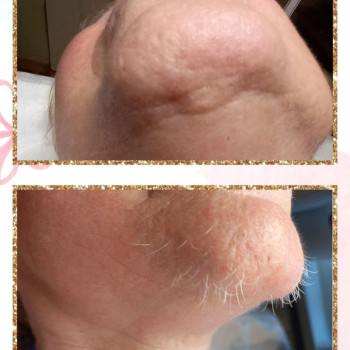 Так набагато краще !