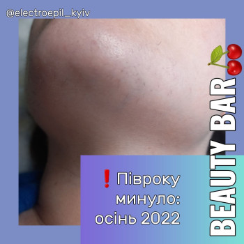 Завершення