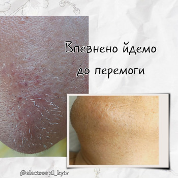 Вже немає проблеми