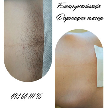 Бікіні зробили якісно.