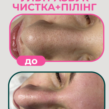 Фото с портфолио Only Girls