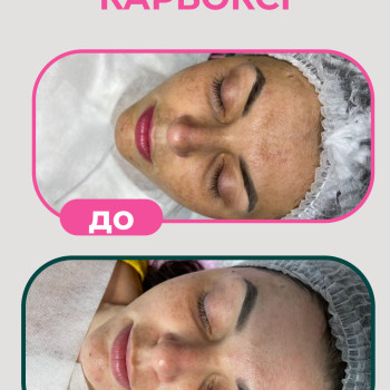 Фото с портфолио Only Girls