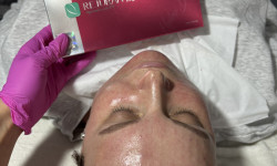 Мезотерапия лица Rejuran Косметолог Татьяна Киев