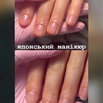 Фото с портфолио MD Beauty Expert
