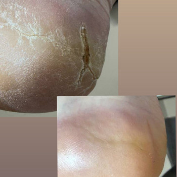 Фото с портфолио Анна Яланська