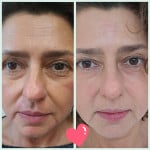 Святковий сет на День народження BELLA Косметолог-эстетист Елена Житомир