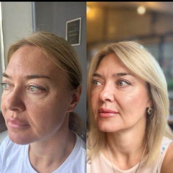 Фото с портфолио Натали Ткаченко