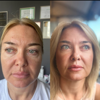 Фото с портфолио Натали Ткаченко