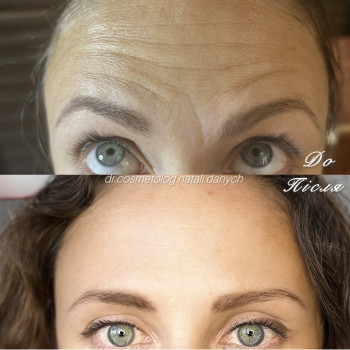 Фото с портфолио Натали Ткаченко