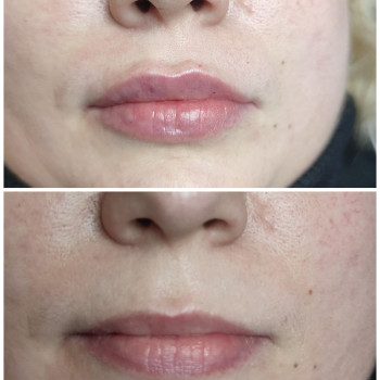 Фото с портфолио Людмила Кырий