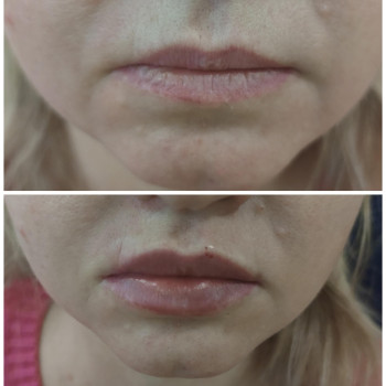 Фото с портфолио Людмила Кырий