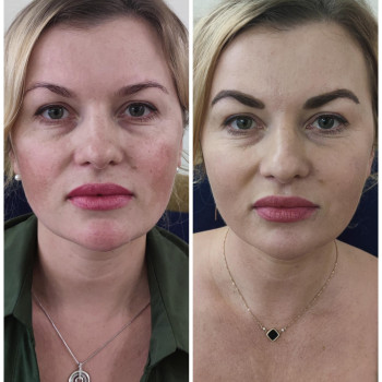 Фото с портфолио Людмила Кырий