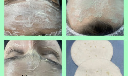 Чистка обличчя Мастер по пирсингу Татьяна Киев