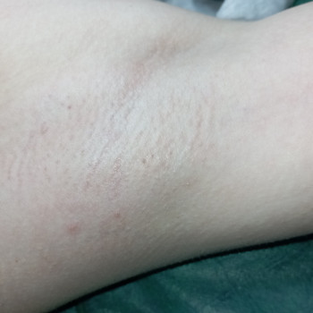 Фото с портфолио Тетяна Квач