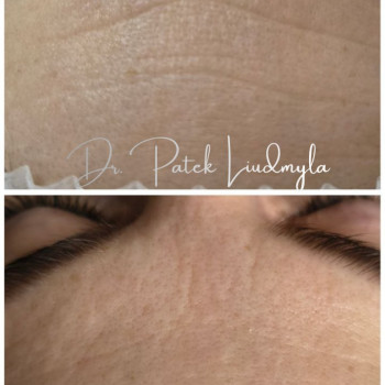 Фото с портфолио Людмила Патек