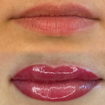 Мікропігментація губ