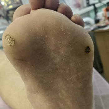 Фото с портфолио Наомі