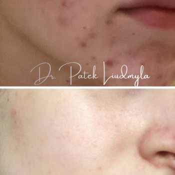 Фото с портфолио Людмила Патек