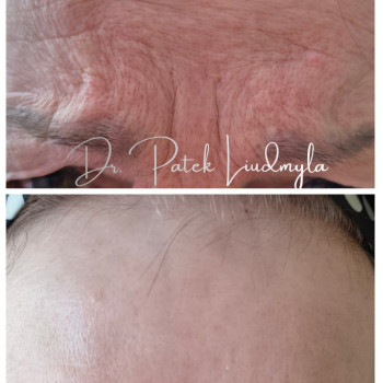 Фото с портфолио Людмила Патек