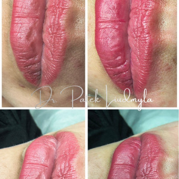 Фото с портфолио Людмила Патек