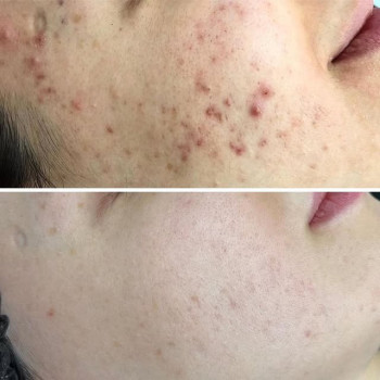 Фото с портфолио Яна Саманчук