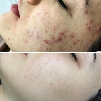 Фото с портфолио Яна Саманчук