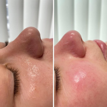 Фото с портфолио Яна Саманчук