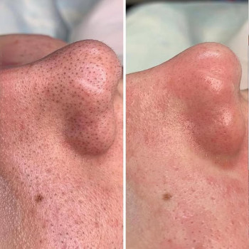 Фото с портфолио Яна Саманчук