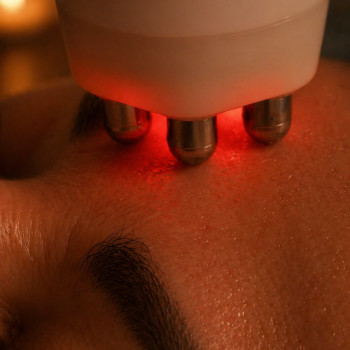 Рф-ліфтинг для обличчя