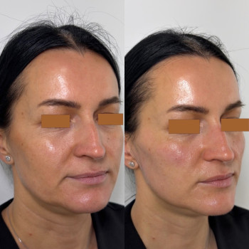 Фото с портфолио Вікторія Іваськевич