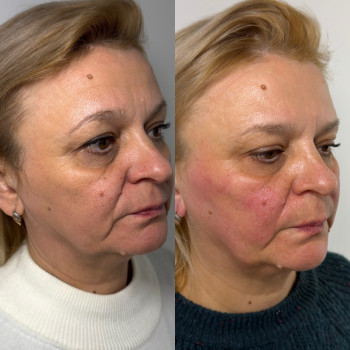 Фото с портфолио Вікторія Іваськевич