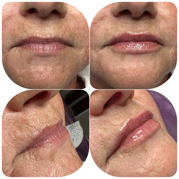 Фото с портфолио Лариса Петрівна