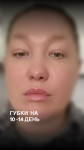 Спокусливі губи Косметолог-ін'єкціоніст Ольга Київ