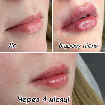 Фото с портфолио Віра Прудська
