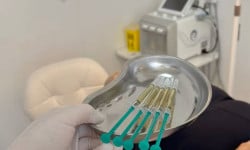 Плазмотерапія шкіри обличчя з цитратом натрію Студия лазерной эпиляции Центр лазерної косметології Луцк