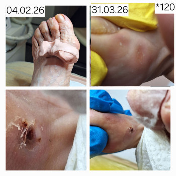 Фото с портфолио Анжела Кротенко