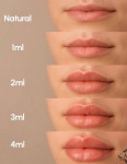 Збільшення губ за супер ціною Косметології Healthy & beauty club Київ