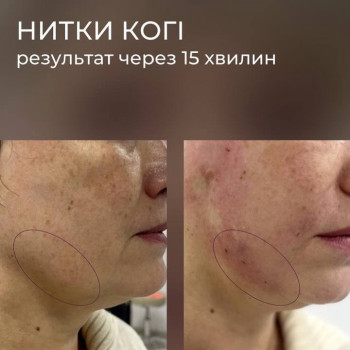 Фото с портфолио Ольга Сигорських