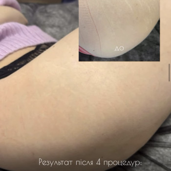 Фото с портфолио Аліна Коломоєць