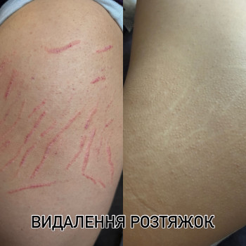 Фото с портфолио Аліна Коломоєць