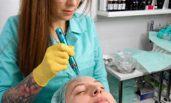 Микронидлинг (Dermapen) – увлажнение, лифтинг, выравнивание тона. Косметолог Анна Вінниця