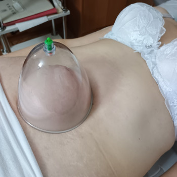 Покращуємо роботу організму зсередини за допомогою вакууму. Баночний масаж живота — відмінний вибір для тих, хто прагне нормалізувати травлення, зменшити набряклість та позбутися почуття напруги в цій зоні. ​
