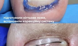 NiTi Подолог Елена Киев