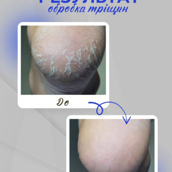 Фото с портфолио Твоя стопа