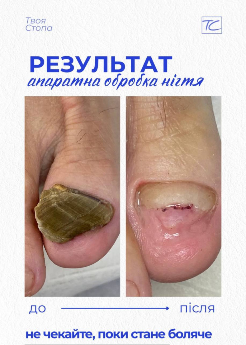 Фото с портфолио Твоя стопа