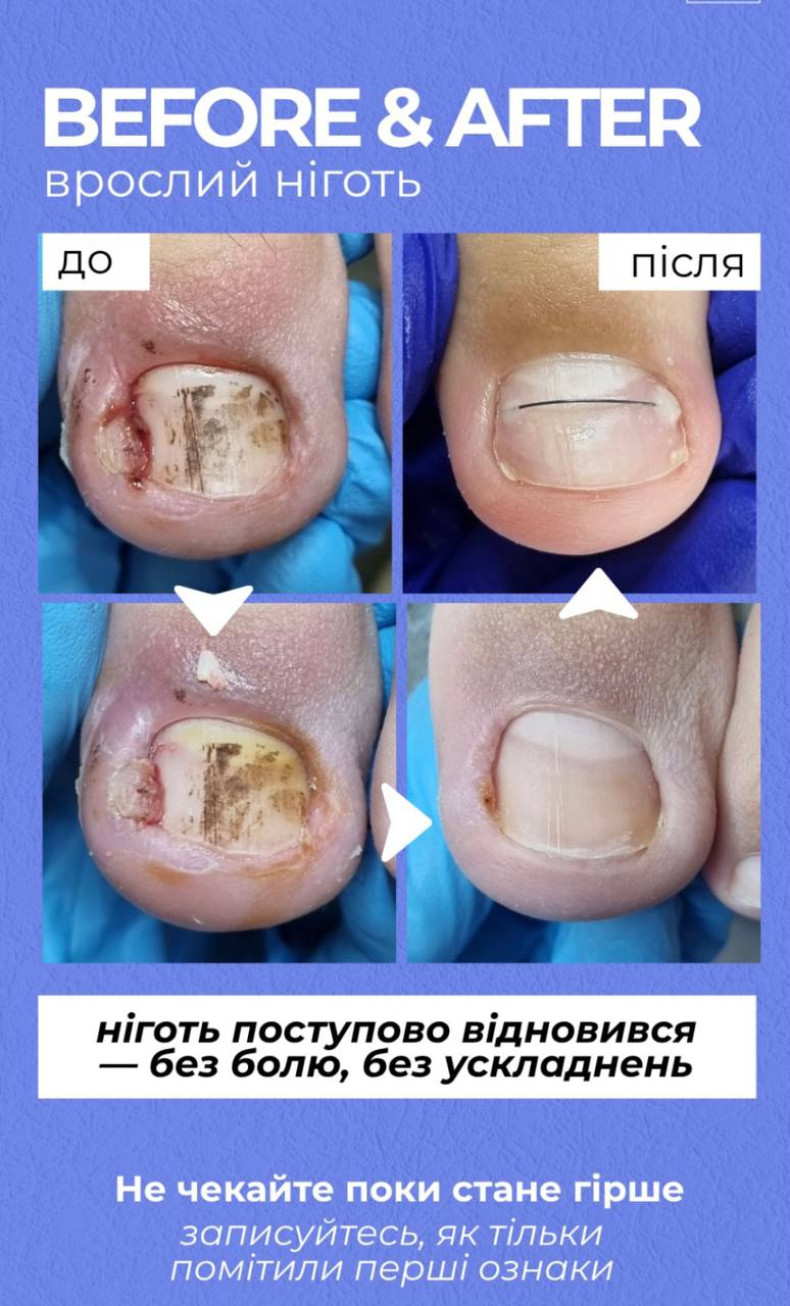 Фото с портфолио Твоя стопа