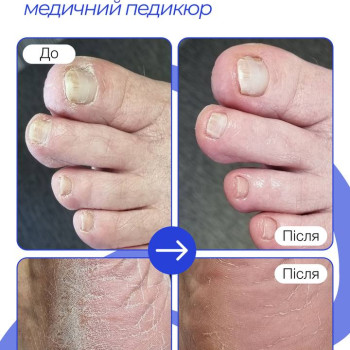 Фото с портфолио Твоя стопа
