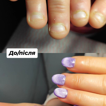 Нігті-гризунчики → повне перевтілення 💅